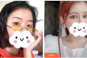 武漢佰視達(dá)眼科門(mén)診部林曉冬整形價(jià)格表附眼部綜合案例展示