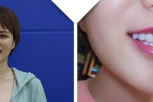 黃石現(xiàn)代口腔醫(yī)院趙險(xiǎn)蓉整形價(jià)格表附牙貼面案例展示