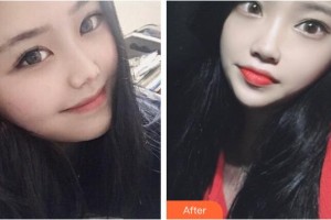 十堰安琪兒醫(yī)學(xué)美容門診部馬永奎整形價格表附熱拉提案例展示