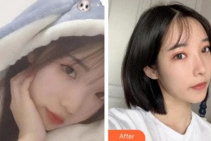 十堰愛(ài)爾眼科醫(yī)院戴鴻斌整形價(jià)格表附眼部綜合案例展示