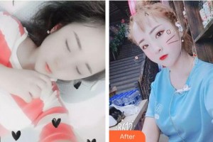 十堰愛(ài)爾眼科醫(yī)院翟坤顏整形價(jià)格表附眼部綜合案例展示