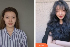 十堰愛(ài)爾眼科醫(yī)院王勇整形價(jià)格表附眼部修復(fù)案例展示