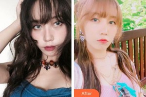 襄陽維多利亞醫(yī)療美容醫(yī)院張世蓮整形價格表附清潔祛痘案例展示