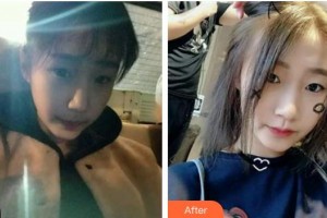 襄陽漢辰醫(yī)療美容門診部楊俊超整形價格表附光子嫩膚案例展示