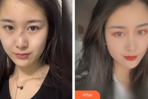 襄陽漢辰醫(yī)療美容門診部郭同榮整形價格表附激光祛疤案例展示