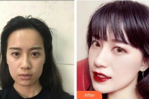 襄陽市中心醫(yī)院整形美容科靳軍華整形價(jià)格表附無針?biāo)獍咐故?>
</a>
<h3 class=