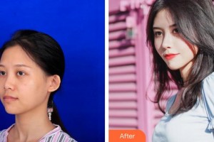 襄陽維多利亞醫(yī)療美容醫(yī)院洪正秀整形價(jià)格表附鼻部綜合案例展示