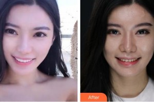 襄陽伊萊美醫(yī)療美容醫(yī)院沈?qū)W洙整形價(jià)格表附美白貼片案例展示