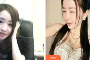 襄陽韓素整形美容門診部周創(chuàng)業(yè)整形價(jià)格表附鼻部綜合案例展示