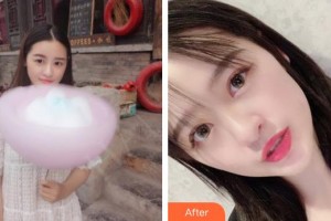 襄陽愛爾眼科醫(yī)院胡天勇整形價格表附切開雙眼皮案例展示