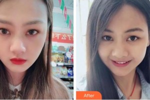 襄陽(yáng)維樂(lè)口腔門診部謝碧亨整形價(jià)格表附牙齒隱形矯正案例展示