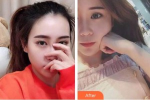 襄陽(yáng)佳潔口腔醫(yī)院張利平整形價(jià)格表附牙齒隱形矯正案例展示