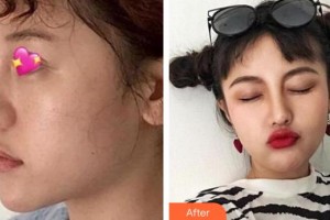 九江圣嘉麗醫(yī)療美容門診部樸濬整形價格表附鼻部綜合案例展示