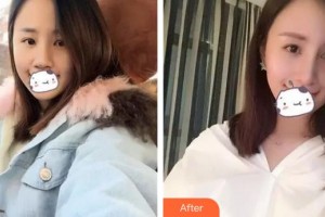 九江風(fēng)華醫(yī)療美容門診部李風(fēng)華整形價格表附膨體隆鼻案例展示