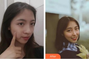 九江圣嘉麗醫(yī)療美容門診部王守文整形價格表附鼻部綜合案例展示