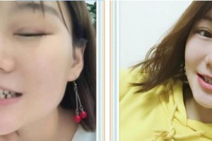 九江奇洋口腔門診部鄢智整形價格表附牙齒隱形矯正案例展示