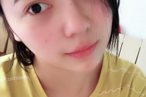 贛州亞韓醫(yī)療美容門診部金輝整形價格表附隆鼻案例展示