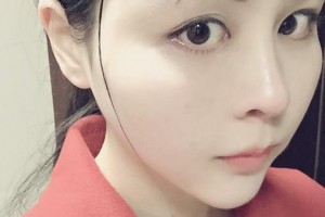 贛州市贛南醫(yī)學院第一附屬醫(yī)院整形美容科謝林海整形價格表附埋線提升案例展示