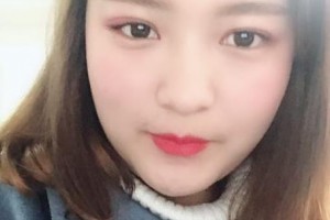 贛州愛爾眼科醫(yī)院繆桂英整形價格表附雙眼皮案例展示