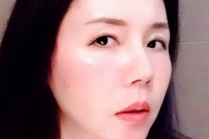 贛州維樂口腔門診部朱生龍整形價格表附牙綜合案例展示