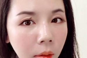 贛州何勤口腔診所何勤整形價格表附牙齒矯正案例展示