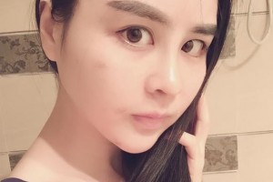 吉安天使醫(yī)療美容診所郭峰整形價(jià)格表附嫩膚案例展示