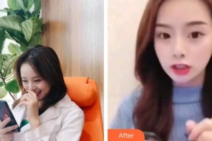 宜春學(xué)院整形美容醫(yī)院王小麗整形價(jià)格表附超聲波潔牙案例展示