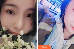 宜春韓美醫(yī)療美容門(mén)診部劉興達(dá)整形價(jià)格表附牙齒隱形矯正案例展示