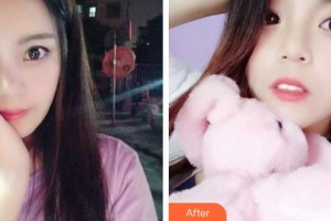 上饒維樂陽光口腔門診部梅健整形價格表附牙齒隱形矯正案例展示