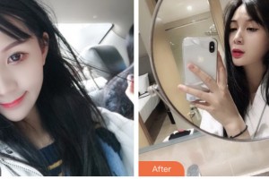 昆山百達(dá)麗醫(yī)療美容門診部劉瑩整形價(jià)格表附光子嫩膚案例展示