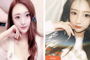 昆山益達口腔門診部萬東元整形價格表附超聲波潔牙案例展示