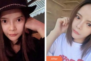 昆山拜博口腔門診部肖求義整形價格表附牙齒隱形矯正案例展示