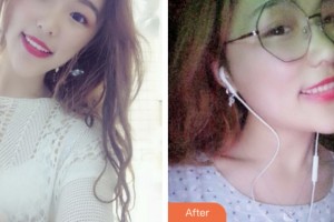 鹽城倍美永康口腔門(mén)診部高麗整形價(jià)格表附冷光美白案例展示