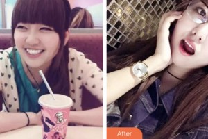 荊門小白兔口腔醫(yī)院杜耿整形價(jià)格表附金屬托槽矯正案例展示