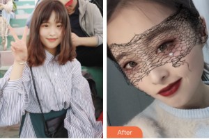 株洲中雅醫(yī)療美容門診部喻欣整形價格表附肋軟骨隆鼻案例展示