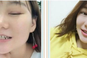 泰州泰勒美整形美容醫(yī)院艾竹林整形價格表附口腔牙齒矯正案例展示