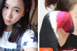 鎮(zhèn)江華儷醫(yī)療美容門診部劉蘭芳整形價(jià)格表附膨體隆鼻案例展示