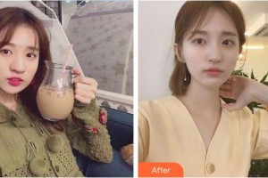 湘潭市中心醫(yī)院醫(yī)學(xué)整形美容科李為儒整形價(jià)格表附鼻部綜合案例展示