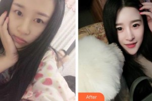 湘潭市紅十字仁和醫(yī)院整形美容中心譚可意整形價(jià)格表附鼻部綜合案例展示