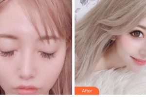 湘潭華美整形醫(yī)院譚兵整形價(jià)格表附鼻部綜合案例展示