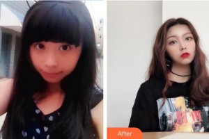 湘潭雅美醫(yī)療美容醫(yī)院白果整形價(jià)格表附鼻部綜合案例展示