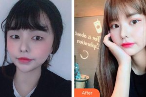 湘潭市中心醫(yī)院醫(yī)學(xué)整形美容科周牡丹整形價(jià)格表附眼部綜合案例展示