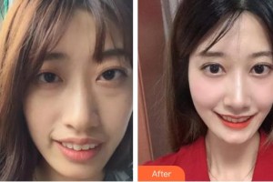 永州牙博士口腔醫(yī)院羅揚力整形價格表附牙齒陶瓷矯正案例展示