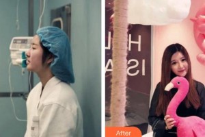 天水瑪莉亞（原女子）醫(yī)院醫(yī)學整形中心李曉愛整形價格表附鼻部綜合案例展示