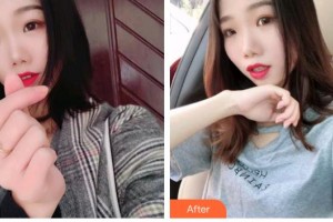 天水退休專家醫(yī)院醫(yī)療美容科杜海英整形價格表附牙齒隱形矯正案例展示