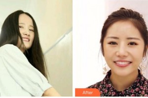 天水市中西醫(yī)結合醫(yī)院口腔頜面外科盧軍勝整形價格表附牙齒隱形矯正案例展示