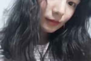 北京圣嘉榮醫(yī)療美容醫(yī)院磨骨好不好？附黃大勇磨骨案例