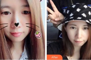 解放軍總醫(yī)院第一附屬醫(yī)院燒傷整形科郝岱峰整形價(jià)格表附埋線雙眼皮案例展示