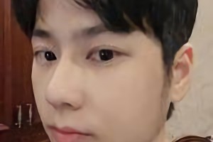 暨南大學(xué)附屬深圳華僑醫(yī)院季如恭下頜角整形怎么樣？附術(shù)后對比圖