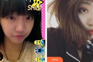 第四軍醫(yī)大學(xué)唐都醫(yī)院整形激光美容中心趙新華整形價(jià)格表附鼻部綜合案例展示